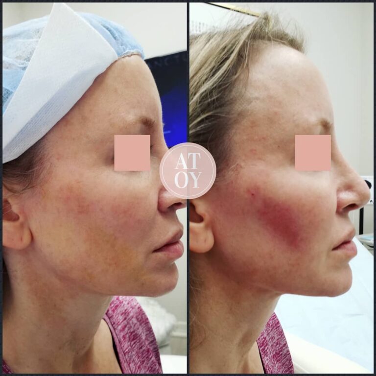 ATouchofYouth4 768x768