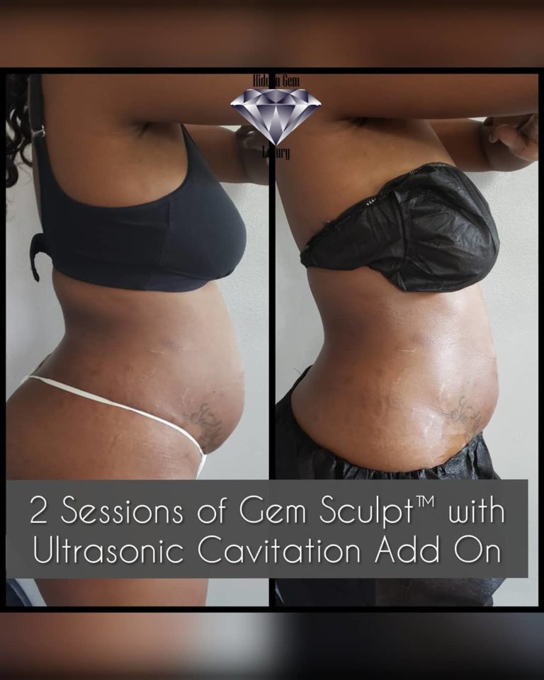 HiddenGemLux1 768x960