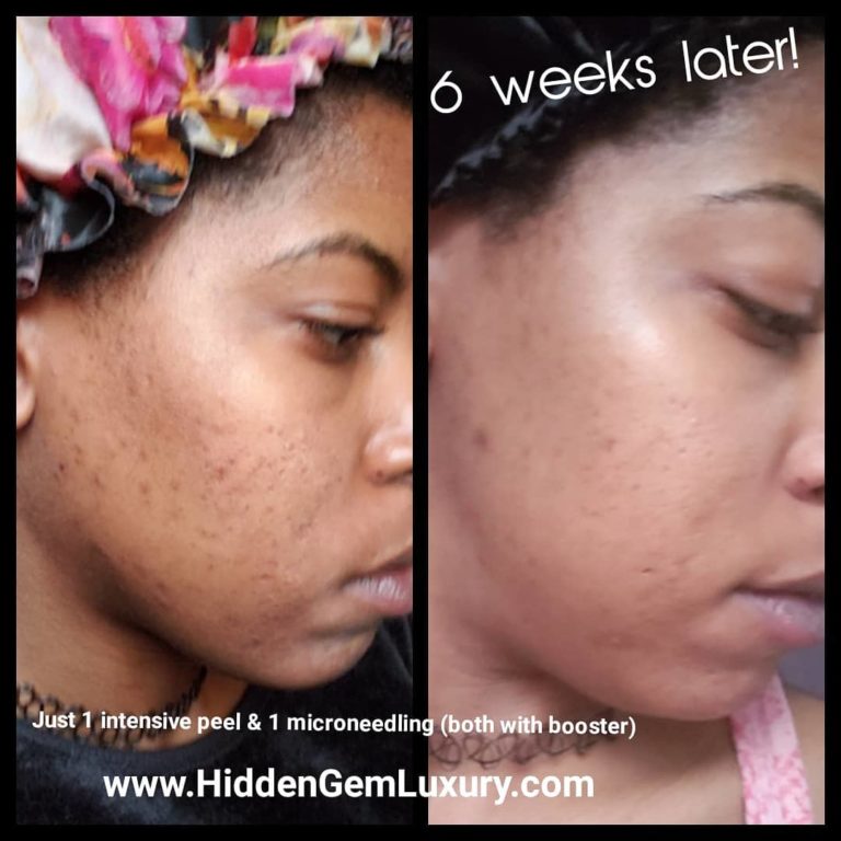 HiddenGemLux3 768x768